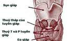 Điều trị Basedow bằng thuốc phóng xạ i-ốt: Cảnh giác với những biến chứng